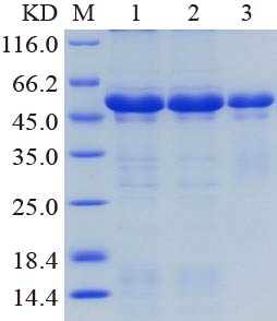 SDS-PAGE analysis of purified recombinant RAD51_G151D, His tag<br />Lane M: Protein Marker<br />Lane 1: Un-purified<br />Lane 2: Flow through,<br />Lane 3: Elution